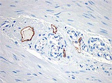 1_D2-40_Purified_D2-40_Lymphatic_Endothelial_Marker_Antibody_IHC_030615