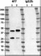 4F7_PURE_beta-Dystroglycan_Antibody_1_WB_053017
