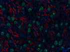 A20069I_PURE_ACE2_Antibody_1_061720.png