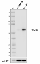 W19264A_PURE_PPM1B_Antibody_2_081921.png