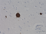 A_Syn204_Ascites_a-Synuclein_IHC_110918