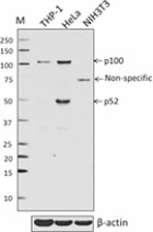 W16082A_PURE_NF-kappaB2_Antibody_1_WB_030617