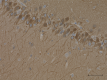 3_2E2dotD11_Purified_PPP3CA_Antibody_2_020619_updated.png