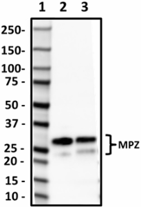58A_HRP_Myelin_Protein_Zero_Antibody_1_062119