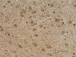 2_5G3_PURE_PPP2R4_Antibody_2_121918.png