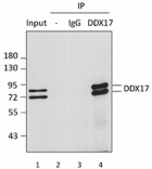 7G6B09_PURE_DDX17(p82_P72)_Antibody_3_IP_060816
