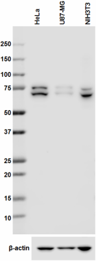 7G6B09_PURE_DDX17(p82_P72)_Antibody_1_WB_071916
