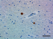 A17183A_HRP_alpha-Synuclein_2_101519.png