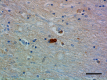 A17183A_HRP_alpha-Synuclein_3_101519.png