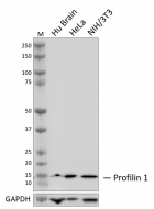 A_A18224E_PURE_Profilin-1_Antibody_WB_012624