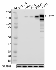 1_A19002A_PURE_EGFR_Antibody_1_111219_updated.png