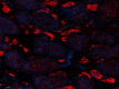 A20069I_PURE_ACE2_Antibody_3_061720.png