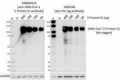 AM004414_PURE_SARS-CoV2_Antibody_RECOM_100920