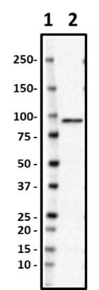 CPTC-Gelsolin-2_HRP_Gelsolin_Antibody_2_01072.png