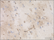 E5206_PURE_-Aquaporin-4_Antibody_2_120721