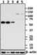 B_F45P9C7_PURE_hnRNPK_Antibody_WB_081616