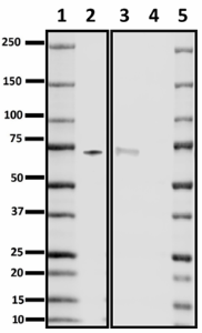 G81-2_PURE_Fibrinogen_Antibody_1_102220