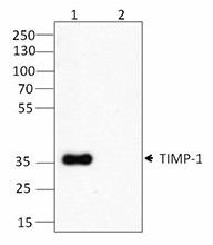 M2004D03_Purified_TIMP-1_Antibody_WB_033115