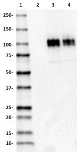 M3dot2_HRP_beta-amyloid_Antibody_1_041118