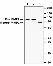 M6308B04_PURE_MMP2_Antibody_WB_092915