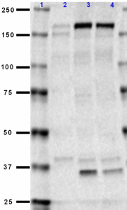 N59slash36_Purified_NMDAR2B_Antibody_1_031618