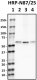 N87-25_HRP_GABRB3_Antibody_1_120418