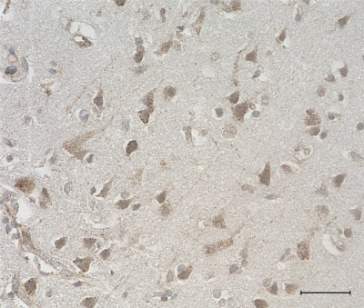 /Files/Images/media_assets/products/product_images/N97Aslash31_Purified_Neuroligin-1_Antibody_1_032218.png