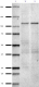 NMDA-Receptor_Antibody_Sampler_Kit_1_110318