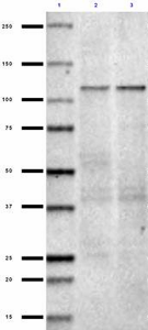 NMDA-Receptor_Antibody_Sampler_Kit_1_110318