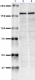 NMDA-Receptor_Antibody_Sampler_Kit_2_110318