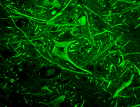 Neurofilament-LMH_Antibody_Sampler_Kit_3_110318