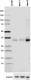 B-O94E6slashARG1_PURE_Arginase-1_Antibody_WB_011718