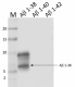 QA19A28_PURE_beta-Amyloid1-38_RECOM_Antibody_4_121420