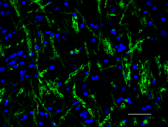 1_SMI-94_A488_Myelin-Basic-Protein_022619.png
