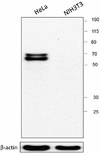 T2JKM3_PURE_TRF2_Antibody_101716