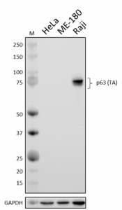 TAp63-4-1_PURE_p63-TA_Antibody_1_080620.png