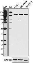 W16104A_PURE_TSC2_Antibody_WB_1_051217