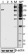 W16104A_PURE_TSC2_Antibody_WB_2_051217