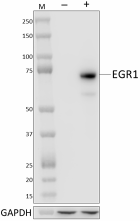 W16161B_PURE_EGR1_Antibody_1_121420