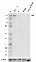 W16190A_PURE_ALK_Antibody_030923