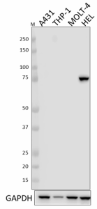 W18031A_PURE_PLZF_Antibody_071519.png