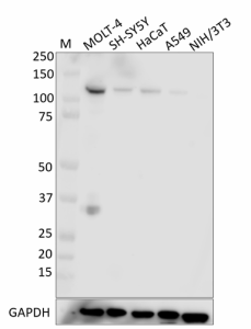 W18116A_PURE_Rb_Antibody_1_093019.png