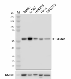W18163A_PURE_SESN2_Antibody_1_072720.png