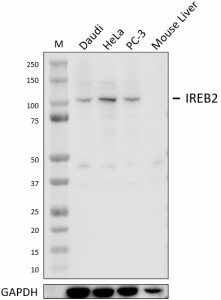 A.
W18260A_PURE_IREB2_Antibody_110222