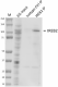 B.
W18260A_PURE_IREB2_Antibody_2_112922