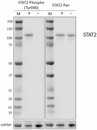 W21151B_PURE_STAT2_Antibody_071423