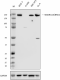 W22111B_PURE_SMARCA4-BRG1_Antibody_2_022224