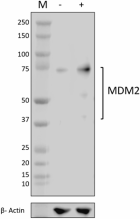 W23003F_PURE_MDM2_Antibody_4_030524