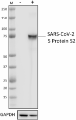 1A9-S2_PURE_SARS-CoV-S-Protein-S2_Antibody_1_120820