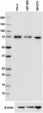 1B5B09_PURE_DDX17(p82)_Antibody_1_WB_071916